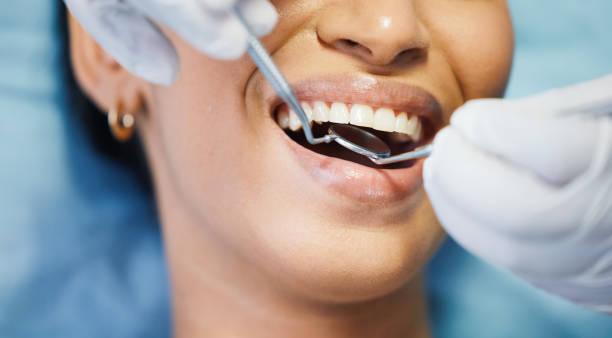 Best Cosmetic Emergency Dentistry in Loyola, CA